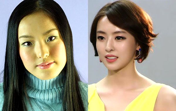 Plastic surgery is so common in south korea